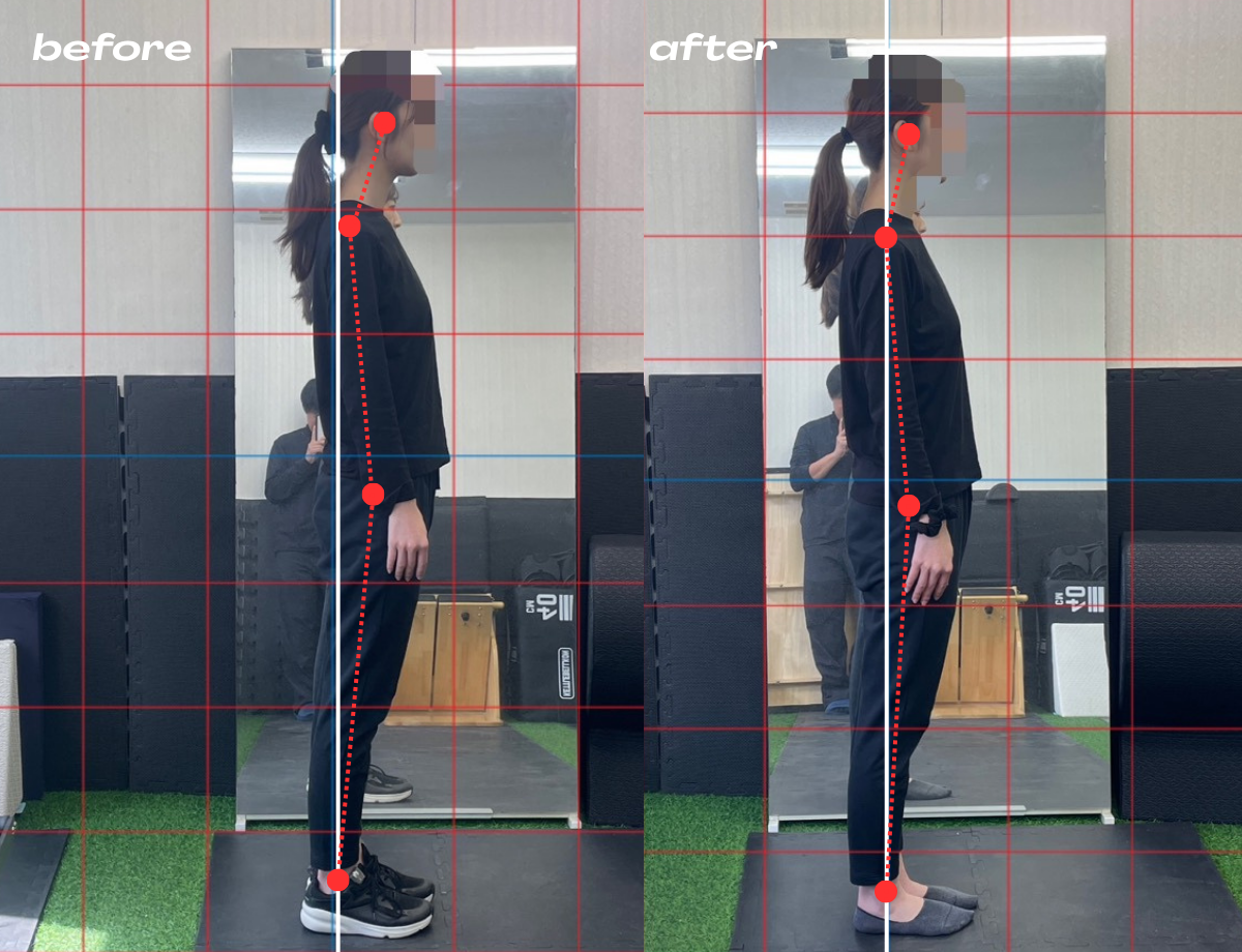 30代女性の姿勢比較。左が実施前、右が6か月実施後。